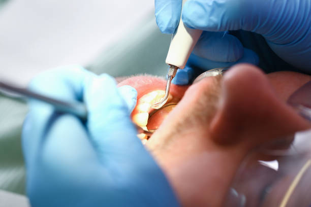Emergency Dentist Open Today in LA