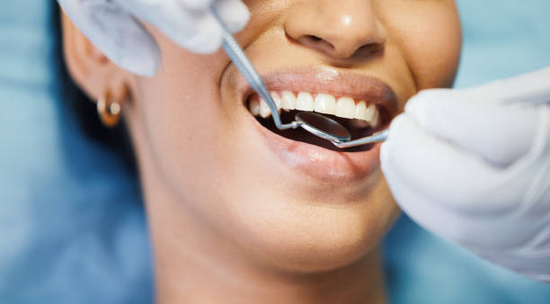 Best Root Canal Emergency Dentist  in Zwolle, LA