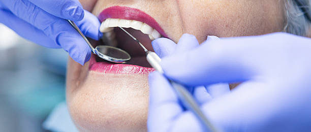 Best Emergency Gum Pain Relief  in Zwolle, LA